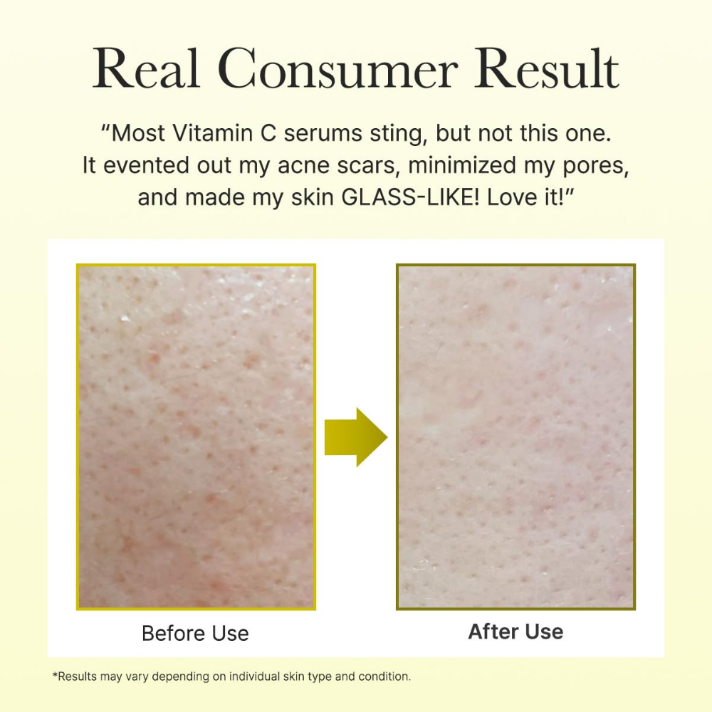 Vitamin C Booster Shot, Pure Vitamin C + Glutathione for Bright, Healthy Skin Glow,