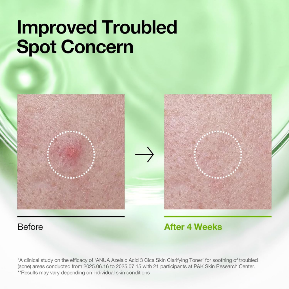 Azelaic Acid 3 CICA Skin Brightening Toner