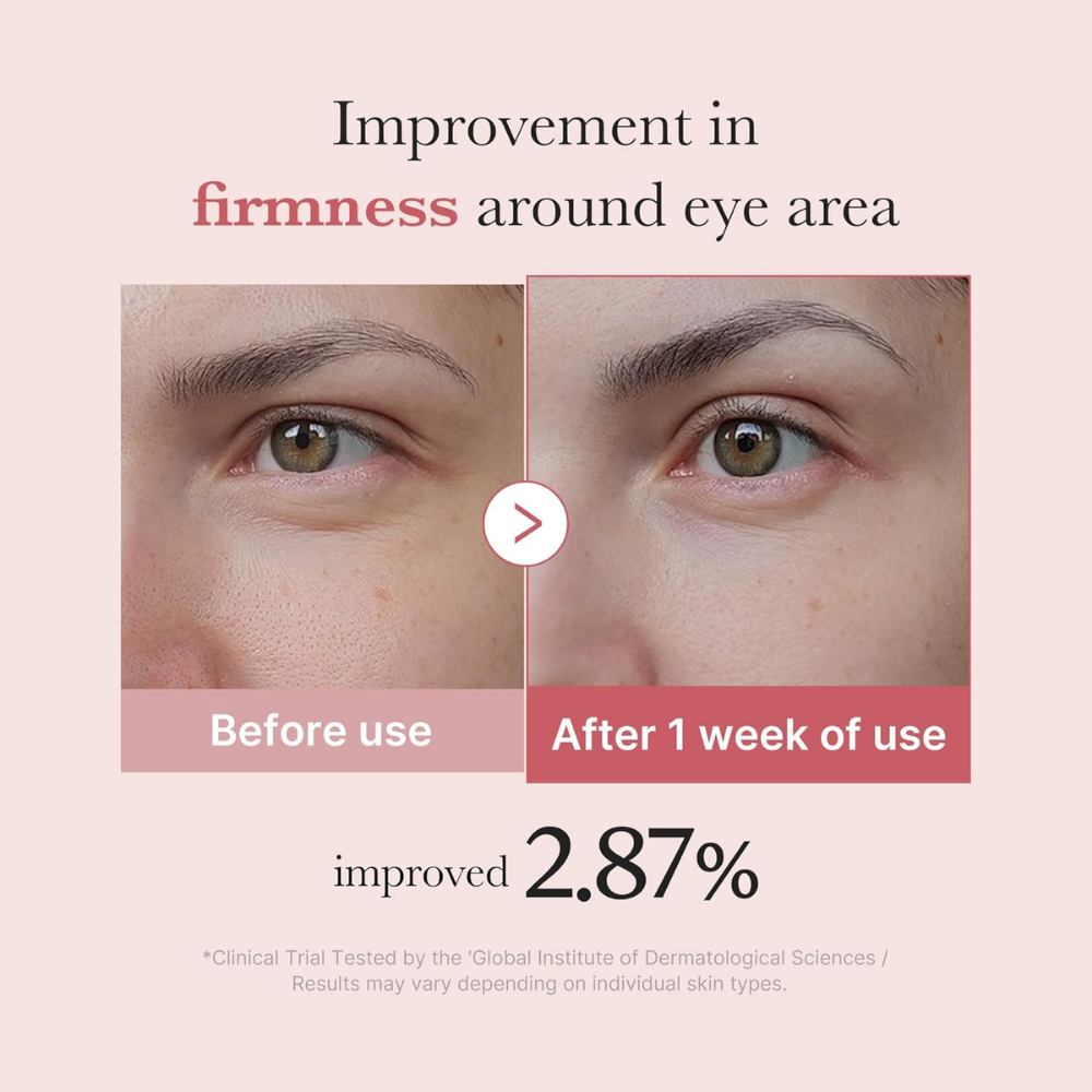 PDRN Pink Peptide Eye Serum - nudemakeupgt