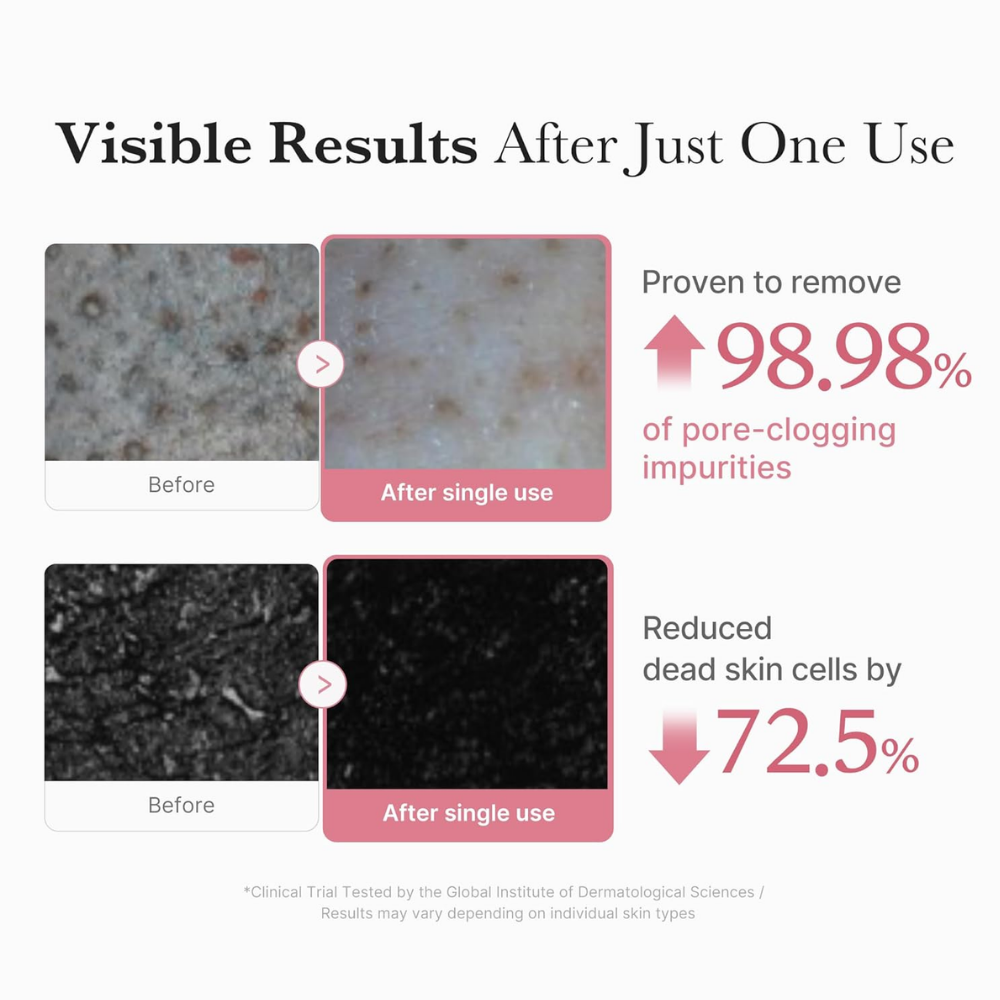 PDRN Pink niacinamide whip cleanser