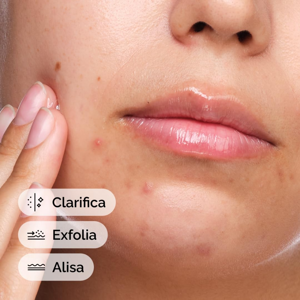 Salicylic acid 2% Solution - nudemakeupgt