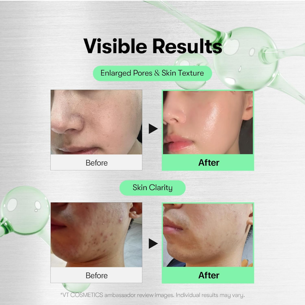 reedle Shot 100, Spicule Microneedling Serum - nudemakeupgt